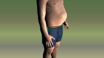 Unexpected Health Risk Associated With Obesity